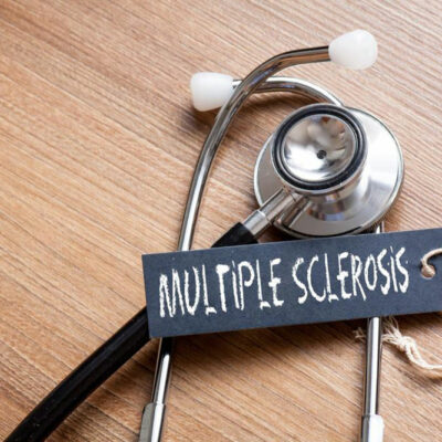 Multiple sclerosis – Things you need to know