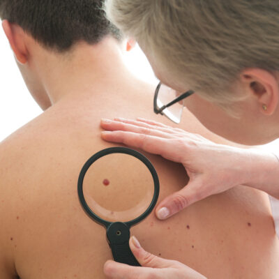 All About Cellulitis – Causes, Symptoms, And Treatment