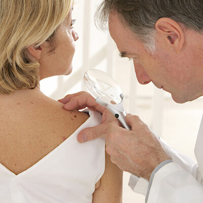 Perioral Dermatitis – Signs, Causes, Diagnosis, and Management